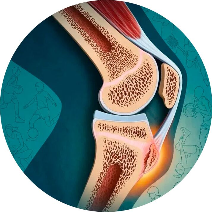 La estructura de la articulación y los tejidos circundantes.