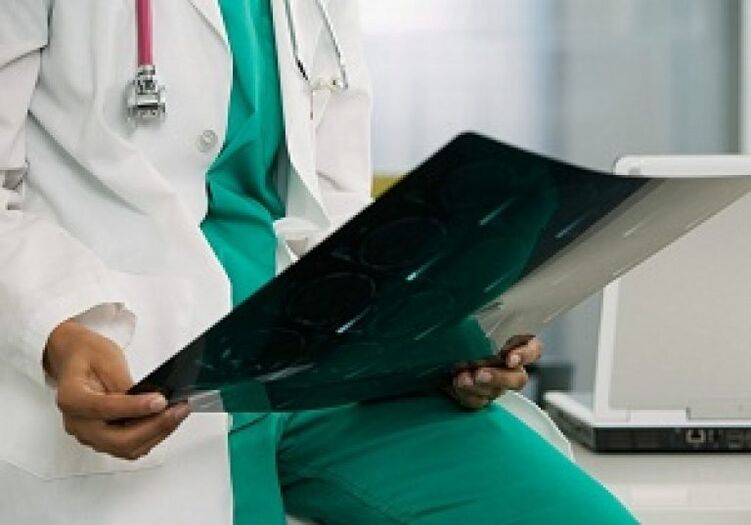 La radiografía ayudará al médico a diagnosticar la osteocondrosis de la columna torácica