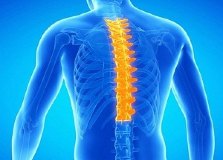 Osteocondrosis de la columna torácica.