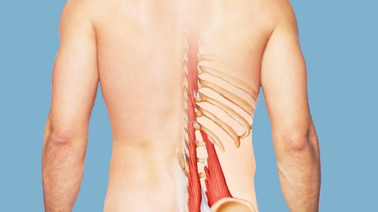 Miositis como causa de dolor lumbar.